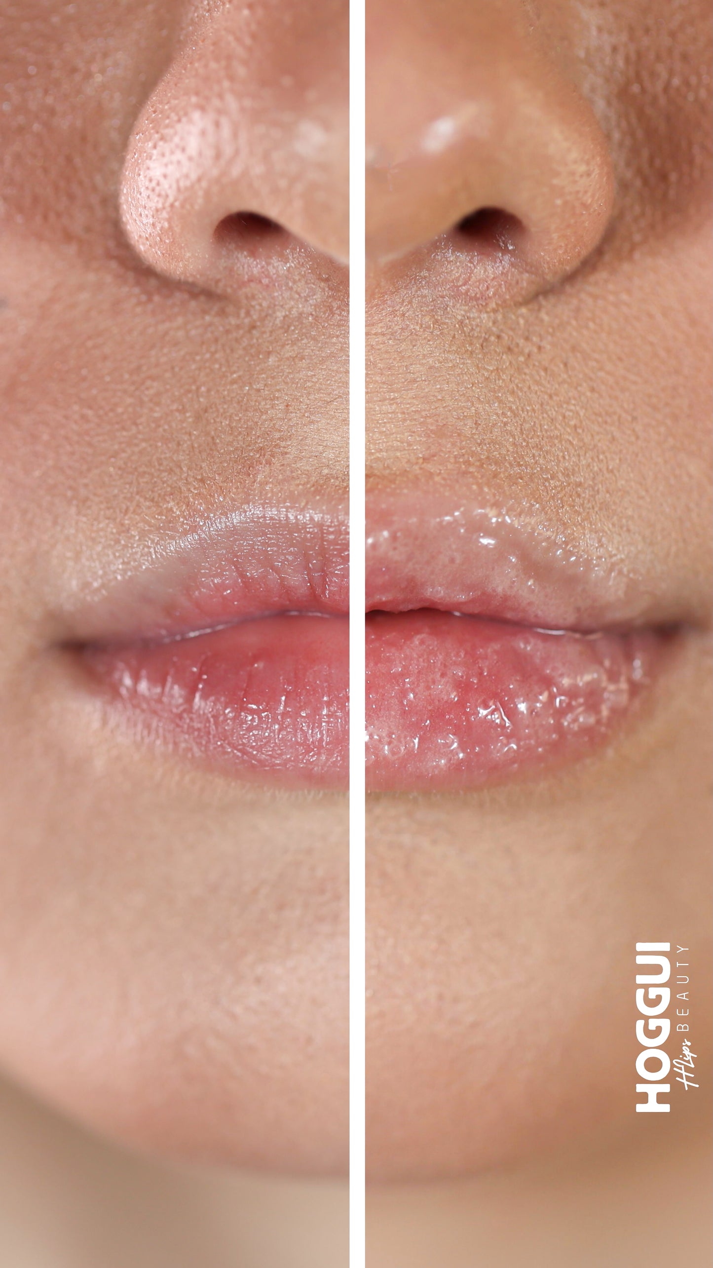 HLips Esfoliador Labial